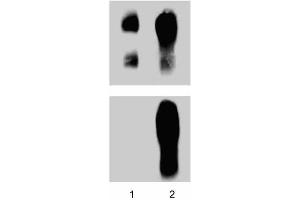 Human Endothelial cells were treated with#1 mM pervanadate for 15 min at 37°C. (CTNND1 抗体  (pTyr228))