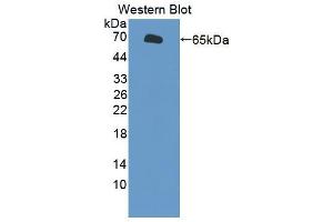 Western blot analysis of the recombinant protein. (SLC26A8 抗体  (AA 664-970))