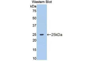 Western Blotting (WB) image for anti-Matrix Metallopeptidase 13 (Collagenase 3) (MMP13) (AA 103-290) antibody (ABIN1172282) (MMP13 抗体  (AA 103-290))