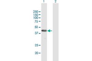 Western Blot analysis of FAM62B expression in transfected 293T cell line by FAM62B MaxPab polyclonal antibody. (FAM62B 抗体  (AA 1-358))