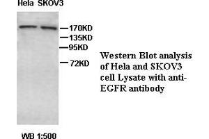 Image no. 1 for anti-Epidermal Growth Factor Receptor (EGFR) antibody (ABIN791216) (EGFR 抗体)