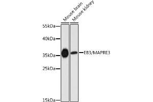 Western Blotting (WB) image for anti-Microtubule-Associated Protein, RP/EB Family, Member 3 (MAPRE3) (AA 1-281) antibody (ABIN6143547)