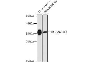 Western blot analysis of extracts of various cell lines, using EB3/EB3/M antibody (ABIN6130540, ABIN6143547, ABIN6143548 and ABIN6225046) at 1:3000 dilution. (MAPRE3 抗体  (AA 1-281))