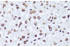Immunohistochemistry of paraffin-embedded Mouse liver using Phospho-ABL1(Y245) Polyclonal Antibody at dilution of 1:100 (40x lens).