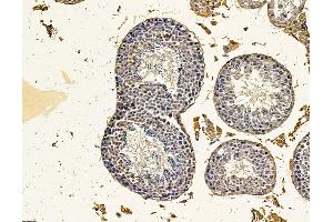 anti-Vacuolar Protein Sorting 37C (VPS37C) antibody