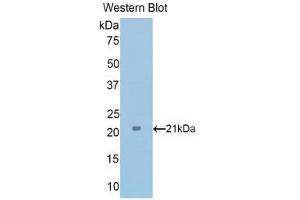 Western Blotting (WB) image for anti-Tumor Protein, Translationally-Controlled 1 (TPT1) (AA 1-172) antibody (ABIN1176579) (TPT1 抗体  (AA 1-172))