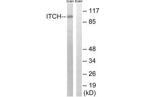 Western Blotting (WB) image for anti-Itchy E3 Ubiquitin Protein Ligase Homolog (ITCH) (Tyr420) antibody (ABIN1848300) (ITCH 抗体  (Tyr420))