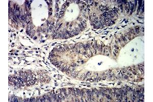 Immunohistochemistry (IHC) image for anti-Tet Methylcytosine Dioxygenase 2 (TET2) antibody (ABIN7193624)