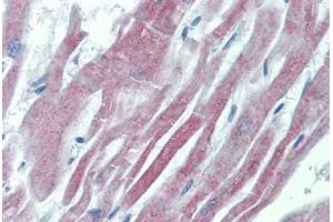 Human Heart: Formalin-Fixed, Paraffin-Embedded (FFPE) (GALR2 抗体  (AA 212-277))