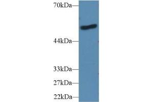 Detection of LBP in Human A431 cell lysate using Polyclonal Antibody to Lipopolysaccharide Binding Protein (LBP) (LBP 抗体  (AA 25-481))