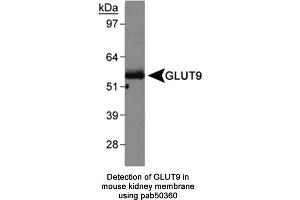 Image no. 1 for anti-Solute Carrier Family 2 (Facilitated Glucose Transporter), Member 9 (SLC2A9) (AA 400-450) antibody (ABIN363669) (SLC2A9 抗体  (AA 400-450))