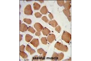 Formalin-fixed and paraffin-embedded human skeletal muscle reacted with PHYH2 Antibody (C-term), which was peroxidase-conjugated to the secondary antibody, followed by DAB staining. (HACL1 抗体  (C-Term))