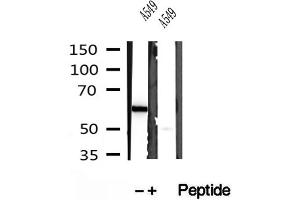 Western blot analysis of extracts of A549 cells, using PFKFB3-Specific antibody. (PFKFB3 抗体  (C-Term))