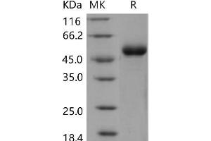 Western Blotting (WB) image for Discoidin Domain Receptor tyrosine Kinase 1 (DDR1) protein (His tag) (ABIN7320131)