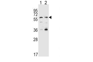 Western Blotting (WB) image for anti-Solute Carrier Family 22 Member 4 (SLC22A4) antibody (ABIN3002503) (SLC22A4 抗体)