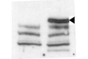 Western blot analysis of anti-JMJD3 C-term Pab (ABIN387863 and ABIN2844040) in untransfected 293 cells (left) and transfected 293 cells (right). (Kdm6b 抗体  (C-Term))