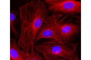 Immunocytochemistry (ICC) image for anti-alpha Tubulin (TUBA1) (AA 443-449) antibody (ABIN1742552) (alpha Tubulin 抗体  (AA 443-449))