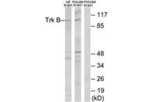 Western blot analysis of extracts from rat brain/mouse brain cells, treated with PBS 60', using Trk B (Ab-515) Antibody. (TRKB 抗体  (AA 481-530))