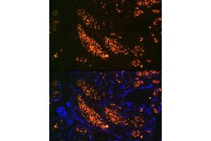 Immunofluorescence analysis of human placenta using HBG1 Rabbit mAb (ABIN1679149, ABIN1679148, ABIN7101336 and ABIN7101337) at dilution of 1:100 (40x lens). (HBG1/2 抗体)