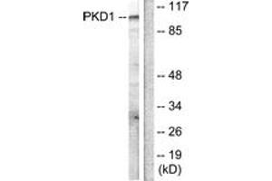 Western blot analysis of extracts from HuvEc cells, treated with PMA 125ng/ml 30', using PKD1/PKC mu (Ab-205) Antibody. (PKC mu 抗体  (AA 171-220))