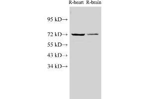 Western Blot analysis of Rat heart and Rat brain using Lamin B1 Polyclonal Antibody at dilution of 1:1000 (Lamin B1 抗体)