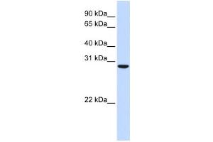 Western Blotting (WB) image for anti-Chromosome 18 Open Reading Frame 10 (C18orf10) antibody (ABIN2459873)
