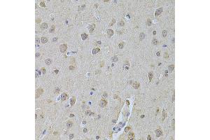 Immunohistochemistry of paraffin-embedded mouse brain using NME1 Antibody (ABIN5970089) at dilution of 1/200 (40x lens). (NME1 抗体  (C-Term))