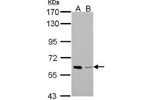 WB Image Sample (30 ug of whole cell lysate) A: A431 B: HeLa 7. (PAK1 抗体  (Center))
