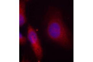Immunofluorescence staining of methanol-fixed HeLa cells using Phospho-SRC-Y529 antibody (ABIN5969948). (Src 抗体  (pTyr529))