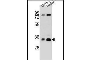 MTHFD2L Antibody (C-term) (ABIN655253 and ABIN2844851) western blot analysis in HepG2,ZR-75-1 cell line lysates (35 μg/lane). (MTHFD2L 抗体  (C-Term))