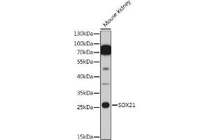 Western blot analysis of extracts of Mouse kidney cells, using SOX21 antibody (ABIN7270574) at 1:1000 dilution. (SOX21 抗体  (AA 167-276))