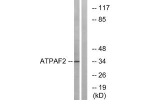 Western blot analysis of extracts from Jurkat cells, using ATPAF2 antibody. (ATPAF2 抗体  (Internal Region))