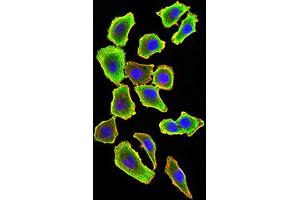 Immunocytochemistry (ICC) image for anti-TNF Receptor-Associated Factor 2 (TRAF2) (AA 39-188) antibody (ABIN5896378) (TRAF2 抗体  (AA 39-188))