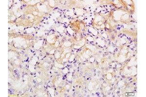 Formalin-fixed and paraffin embedded human kidney tissue labeled with Anti-Acetyl-Histone H1b(K53) Polyclonal Antibody , Unconjugated at 1:200, followed by conjugation to the secondary antibody and DAB staining (Histone H1 抗体  (acLys52))