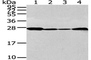 Gel: 12 % SDS-PAGE, Lysate: 40 μg, Lane 1-4: 293T, K562, Jurkat and 231 cell, Primary antibody: ABIN7128063(UCHL3 Antibody) at dilution 1/300 dilution, Secondary antibody: Goat anti rabbit IgG at 1/8000 dilution, Exposure time: 30 seconds (UCHL3 抗体)