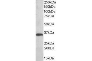 Western Blotting (WB) image for anti-Thioredoxin-Related Transmembrane Protein 1 (TMX1) (C-Term) antibody (ABIN2466410) (TMX1 抗体  (C-Term))
