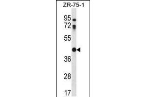 Western blot analysis in ZR-75-1 cell line lysates (35ug/lane). (CTSO 抗体  (N-Term))