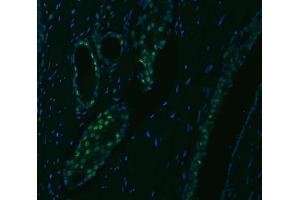 IF analysis of SNRPA1 using anti-SNRPA1 antibody (ABIN7599131).