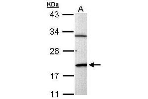WB Image Sample (30 ug of whole cell lysate) A: Raji 12% SDS PAGE antibody diluted at 1:1000 (BCL2-Like 15 抗体)
