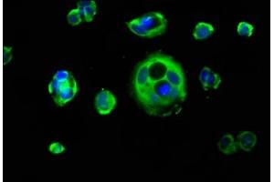 Immunofluorescence staining of MCF-7 cells with ABIN7157412 at 1:133, counter-stained with DAPI. (Cytokeratin 1 抗体  (AA 267-438))