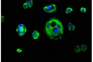 Immunofluorescence staining of MCF-7 cells with ABIN7157412 at 1:133, counter-stained with DAPI. (Cytokeratin 1 抗体  (AA 267-438))