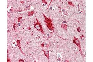 Anti-RASD2 / RHES / DEXRAS1 antibody IHC staining of human brain, cortex. (RASD2 抗体  (AA 86-114))