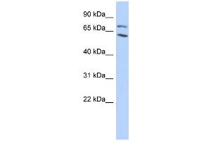 WB Suggested Anti-MTA2 Antibody Titration:  0. (MTA2 抗体  (N-Term))