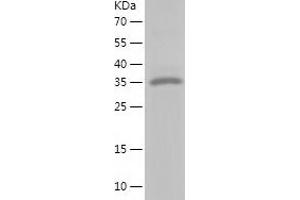 Western Blotting (WB) image for Calponin 1 (CNN1) (AA 1-297) protein (His-IF2DI Tag) (ABIN7122105)