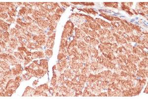 Immunohistochemistry of paraffin-embedded Mouse heart using DES Polyclonal Antibody at dilution of 1:100 (40x lens). (Desmin 抗体)