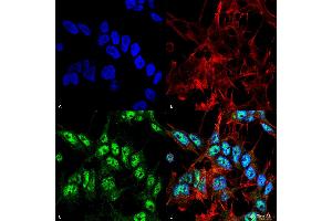 Immunocytochemistry/Immunofluorescence analysis using Rabbit Anti-Beclin 1 Polyclonal Antibody . (Beclin 1 抗体)