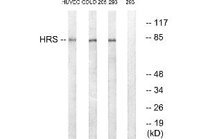 Western blot analysis of extracts from HUVEC cells, COLO cells and 293 cells, using HRS (Ab-334) antibody. (HRS (HRS) (Tyr334) 抗体)