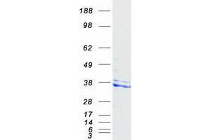 Western Blotting (WB) image for Nudix (Nucleoside Diphosphate Linked Moiety X)-Type Motif 6 (NUDT6) (Transcript Variant 1) protein (Myc-DYKDDDDK Tag) (ABIN2727774)