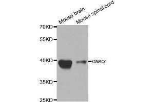 Western blot analysis of extracts of various cell lines, using GNAO1 antibody. (GNAO1 抗体  (AA 60-180))