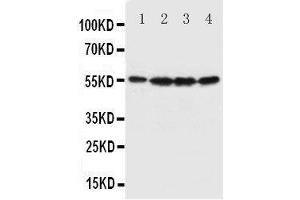 Western Blotting (WB) image for anti-Fascin (FSCN1) (AA 97-113), (N-Term) antibody (ABIN3044444) (Fascin 抗体  (N-Term))